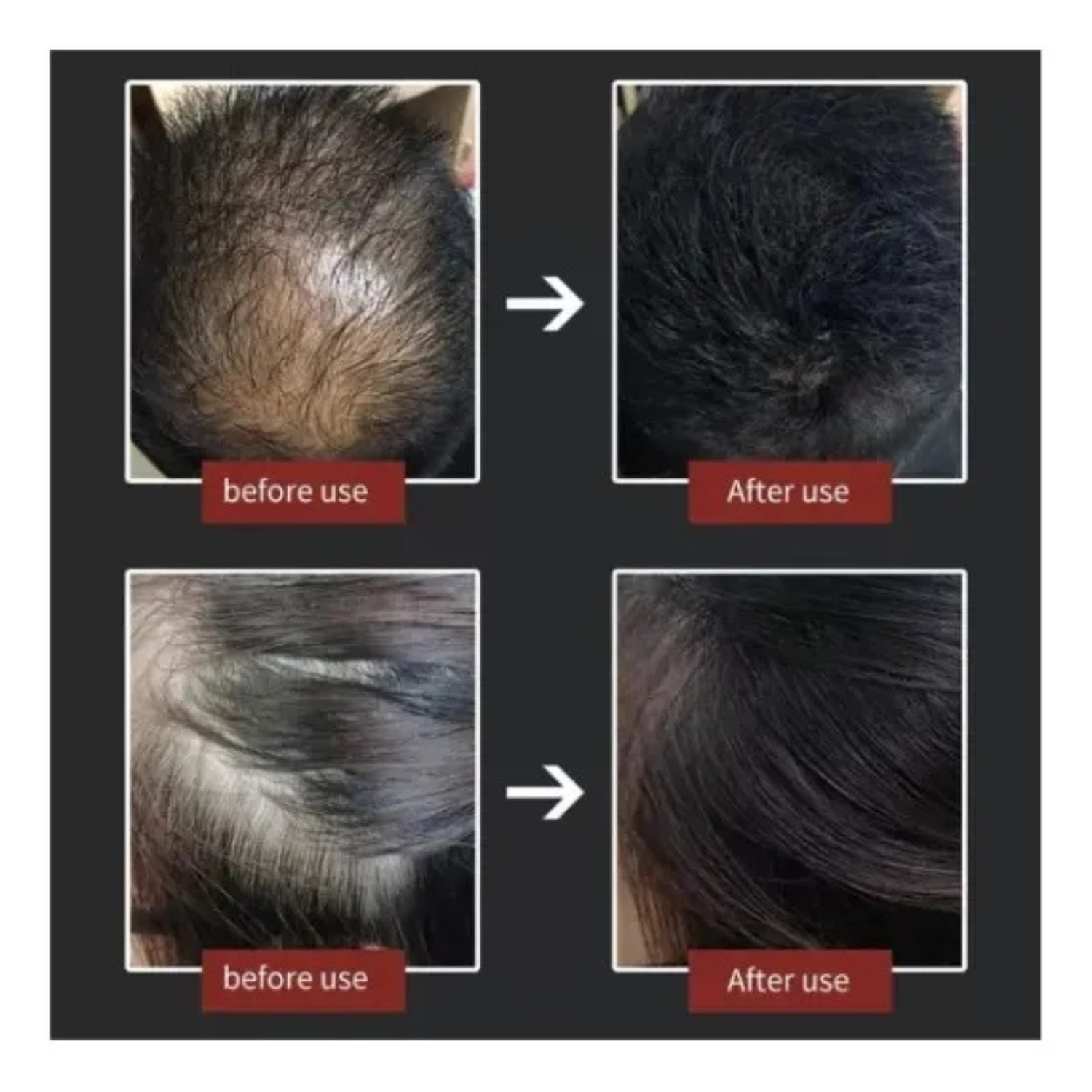 Resultado instantáneo de Toppik negro mostrando cabello más abundante